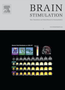 Article published in Brain Stimulation
