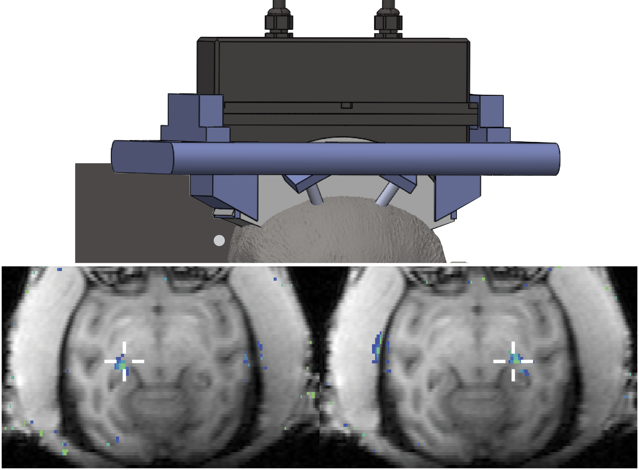 Platform for Remote, Multifocal Brain Interventions